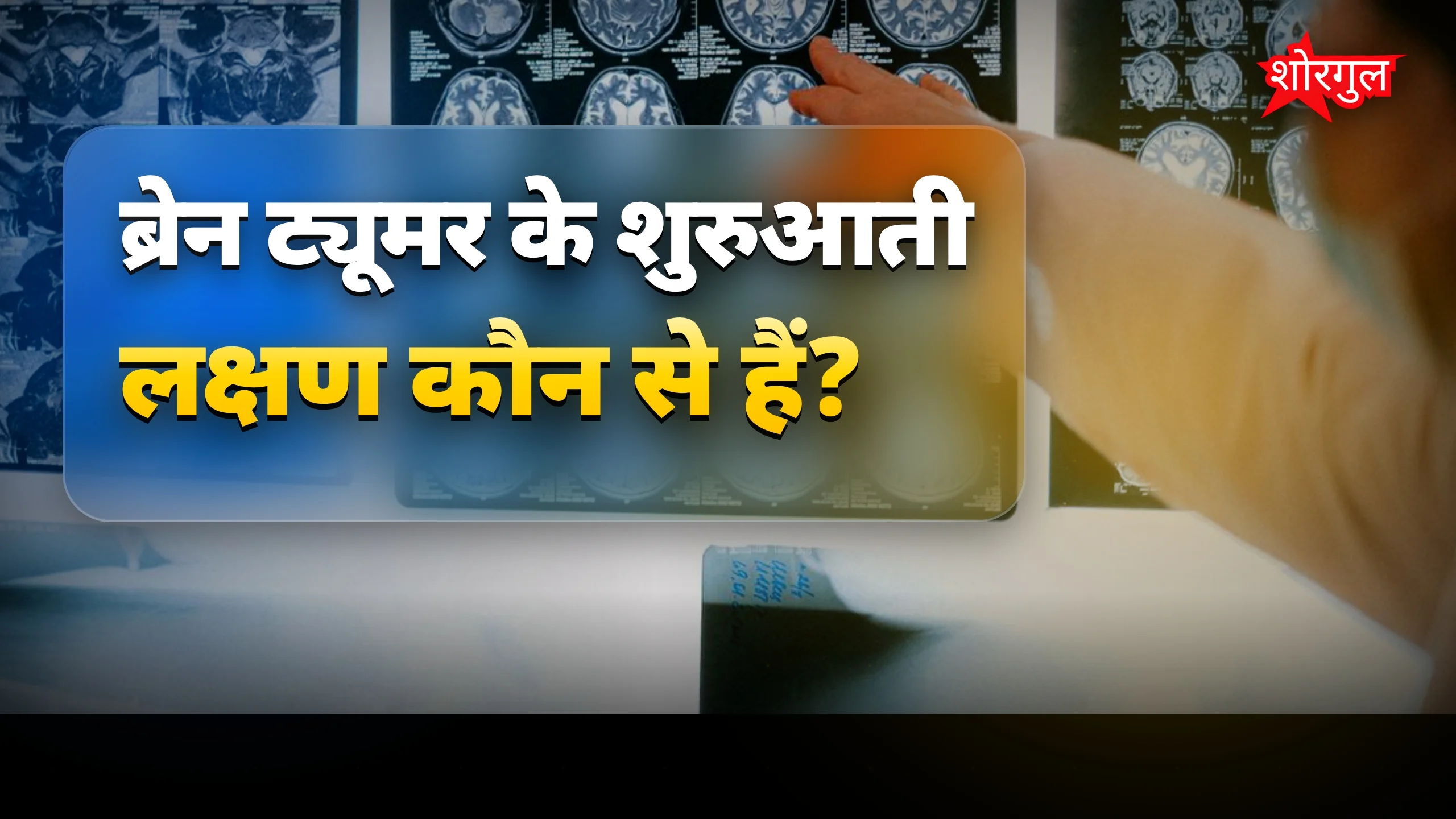 ब्रेन ट्यूमर: शुरुआती लक्षण और बचाव के आसान उपाय