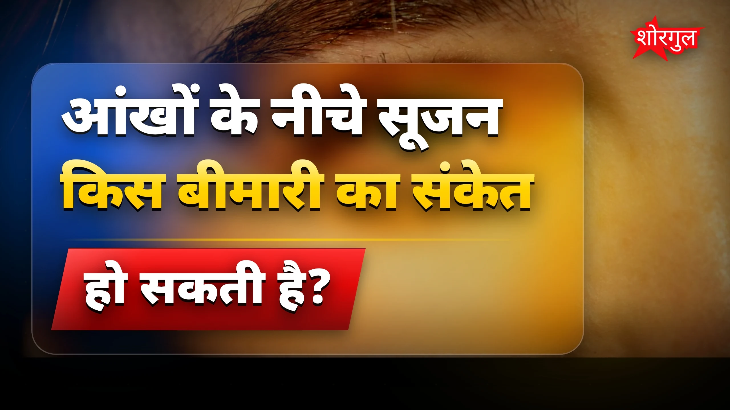 नींद के बाद भी सूजन? ध्यान दें! ⚠️