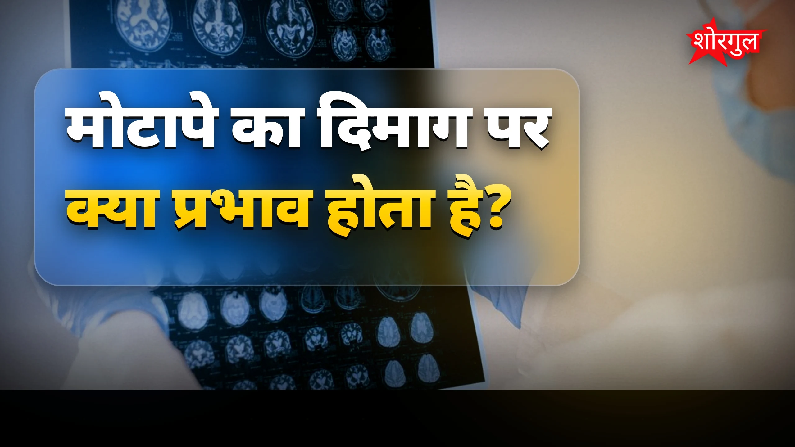 बढ़ता वजन दिमाग के लिए भी खतरा, भूलने की बीमारी बढ़ती है